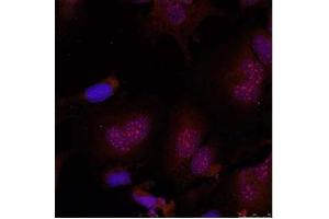 Image no. 2 for anti-Jun B Proto-Oncogene (JUNB) (pSer79) antibody (ABIN196657) (JunB antibody  (pSer79))