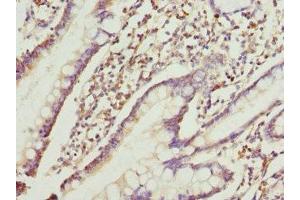 Immunohistochemistry of paraffin-embedded human small intestine tissue using ABIN7167209 at dilution of 1:100 (GTR2 antibody  (AA 1-250))