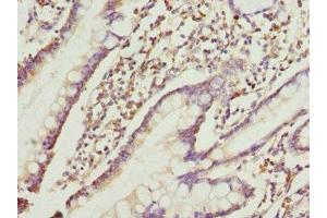 Immunohistochemistry of paraffin-embedded human small intestine tissue using ABIN7167209 at dilution of 1:100 (GTR2 antibody  (AA 1-250))