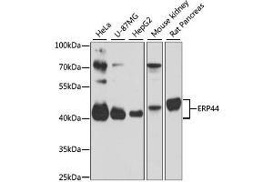 Western blot analysis of extracts of various cell lines, using ERP44 antibody (ABIN6291618) at 1:3000 dilution.