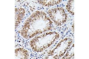 Immunohistochemistry of paraffin-embedded human colon using KIF22 antibody  at dilution of 1:100 (40x lens). (KIF22 antibody  (AA 456-665))