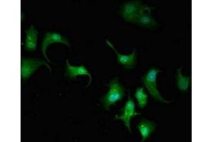 Immunofluorescent analysis of MCF-7 cells using ABIN7143098 at dilution of 1:100 and Alexa Fluor 488-congugated AffiniPure Goat Anti-Rabbit IgG(H+L) (ARPC5L antibody  (AA 15-124))