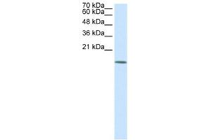 WB Suggested Anti-HDAC6 Antibody Titration:  0. (HDAC6 antibody  (N-Term))