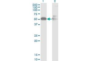 Western Blot analysis of AHSG expression in transfected 293T cell line by AHSG monoclonal antibody (M02), clone 1D8. (Fetuin A antibody  (AA 19-367))