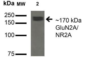 Western Blot analysis of Monkey COS cells transfected with GFP-tagged NR2A showing detection of ~170 kDa GluN2A/NR2A protein using Mouse Anti-GluN2A/NR2A Monoclonal Antibody, Clone S327A-38 . (NMDAR2A antibody  (AA 75-325) (Atto 594))