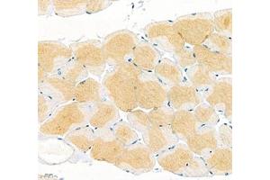 Immunohistochemistry of paraffin embedded mouse skeletal muscle using Junctophilin2 (ABIN7074393) at dilution of 1: 600 (400x lens) (Junctophilin 2 antibody)