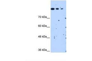 Image no. 2 for anti-SET Domain Containing 2 (SETD2) (AA 323-372) antibody (ABIN321311) (SETD2 antibody  (AA 323-372))