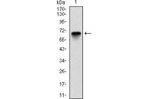 Western blot analysis using G6PD mAb against human G6PD (AA: 275-515) recombinant protein. (Glucose-6-Phosphate Dehydrogenase antibody)