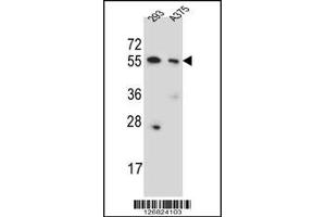 Western blot analysis in 293,A375 cell line lysates (35ug/lane). (CPNE8 antibody  (N-Term))