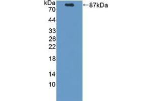 Western blot analysis of recombinant Mouse PCSK9. (PCSK9 antibody  (AA 156-694))
