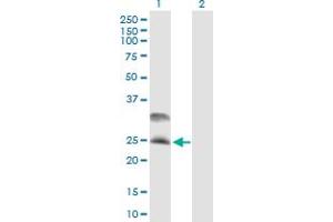 Western Blot analysis of DNAJC5 expression in transfected 293T cell line by DNAJC5 MaxPab polyclonal antibody. (DNAJC5 antibody  (AA 1-198))