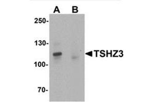 Western blot analysis of TSHZ3 in mouse brain tissue lysate with TSHZ3 / ZNF537 Antibody at 1 µg/ml in (A) the absence and (B) the presence of blocking peptide. (TSHZ3 antibody  (N-Term))