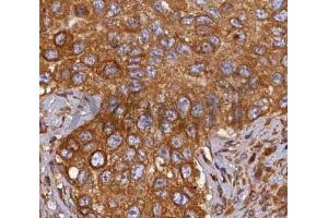 ABIN6268689 at 1/100 staining human breast tissues sections by IHC-P. (HMOX2 antibody  (Internal Region))