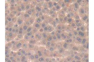 Detection of SEMA3A in Rat Liver Tissue using Polyclonal Antibody to Semaphorin 3A (SEMA3A)