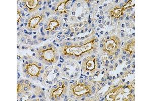 Immunohistochemistry of paraffin-embedded Mouse kidney using ADRBK1 Polyclonal Antibody at dilution of 1:200 (40x lens). (GRK2 antibody)