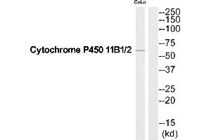Western blot analysis of extracts from COLO205 cells, using Cytochrome P450 11B1/2 antibody. (Cytochrome P450 11B1/2 (C-Term) antibody)