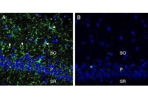 Expression of CX3CR1 in rat hippocampus - Immunohistochemical staining of perfusion-fixed frozen rat brain sections with Anti-CX3CR1 (extracellular) Antibody (ABIN7043047, ABIN7044194 and ABIN7044195), (1:300), followed by goat anti-rabbit-AlexaFluor-488.