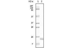 Western Blot showing SNCA antibody used against truncated SNCA recombinant protein. (SNCA antibody)