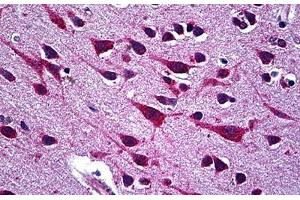 Human Brain, Cortex: Formalin-Fixed, Paraffin-Embedded (FFPE) (CCT5 antibody  (AA 1-542))