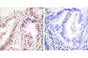 Peptide - + (Estrogen Receptor alpha antibody  (Tyr537))