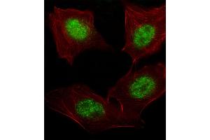 Fluorescent image of A549 cell stained with hARNT-V528. (ARNT antibody  (AA 513-544))