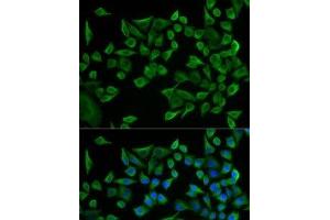 Immunofluorescence analysis of U2OS cells using WARS Polyclonal Antibody (WARS antibody)