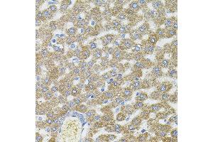Immunohistochemistry of paraffin-embedded rat liver using CEP164 antibody. (CEP164 antibody)