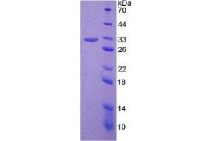 SDS-PAGE of Protein Standard from the Kit (Highly purified E. (PTGS2 ELISA Kit)