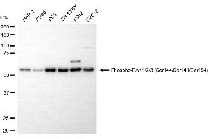 anti-P21-Activated Kinases 1/2/3 (PAK1/2/3) (pSer141), (pSer144), (pSer154) antibody