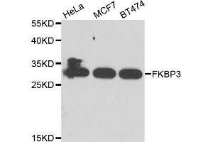 Western blot analysis of extracts of various cell lines, using FKBP3 antibody. (FKBP3 antibody)