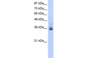 Western Blotting (WB) image for anti-Zinc Finger Protein 197 (ZNF197) antibody (ABIN2461810) (ZNF197 antibody)