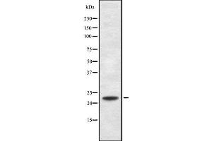 Western blot analysis of RANBP1 using MCF7 whole cell lysates (RANBP1 antibody  (N-Term))
