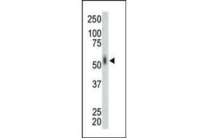 The anti-MKNK2 Pab (ABIN391072 and ABIN2841219) is used in Western blot to detect MKNK2 in mouse lung tissue lysate. (MKNK2 antibody  (N-Term))