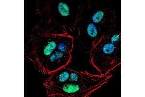 Immunofluorescence (IF) image for anti-PMS2 Postmeiotic Segregation Increased 2 (S. Cerevisiae) (PMS2) (AA 748-851) antibody (ABIN5542596)