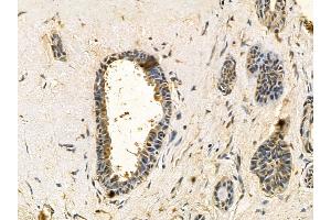 anti-Linker For Activation of T Cells Family, Member 2 (LAT2) antibody