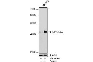Western blot analysis of extracts of NIH/3T3 cells, using Phospho-eIF4E-S209 antibody (ABIN6135213, ABIN6136062, ABIN6136063 and ABIN6225650) at 1:500 dilution.