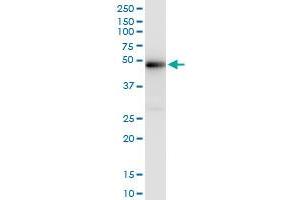 Immunoprecipitation of XRCC4 transfected lysate using anti-XRCC4 MaxPab rabbit polyclonal antibody and Protein A Magnetic Bead , and immunoblotted with XRCC4 MaxPab mouse polyclonal antibody (B01) . (XRCC4 antibody  (AA 1-336))