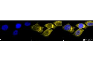 Immunocytochemistry/Immunofluorescence analysis using Rabbit Anti-SOD (Mn) Polyclonal Antibody . (SOD2 antibody  (Atto 488))