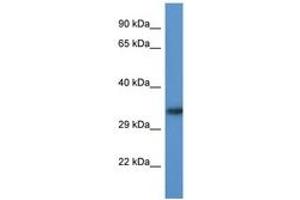 Image no. 1 for anti-Acyl-CoA Binding Domain Containing 6 (ACBD6) (AA 97-146) antibody (ABIN6746823) (ACBD6 antibody  (AA 97-146))