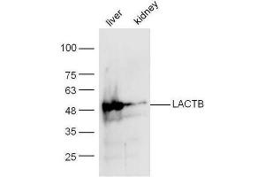 Mouse liver/kidney lysates probed with Anti-LACTB Polyclonal Antibody  at 1:5000 90min in 37˚C. (LACTB antibody  (AA 101-200))