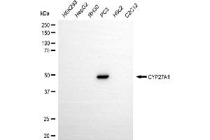 Western blotting analysis using CYP27A1 antibody (ABIN7798258).