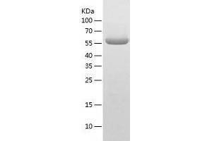 Western Blotting (WB) image for Set1/Ash2 Histone Methyltransferase Complex Subunit ASH2 (ASH2L) (AA 96-628) protein (His tag) (ABIN7289217) (ASH2L Protein (AA 96-628) (His tag))