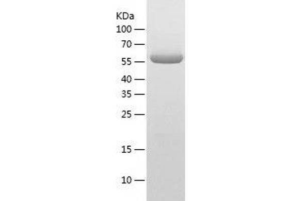 ASH2L Protein (AA 96-628) (His tag)