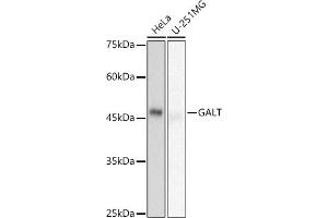 Western blot analysis of extracts of various cell lines, using GALT antibody (ABIN7267332) at 1:500 dilution. (GALT antibody)