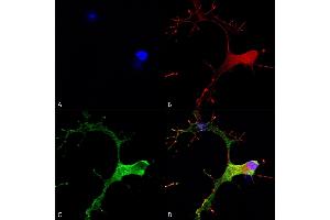 Immunocytochemistry/Immunofluorescence analysis using Mouse Anti-GABA-B Receptor 1 Monoclonal Antibody, Clone S93A-49 (ABIN2484105). (GABBR1 antibody  (AA 873-977) (PE))