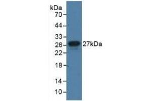 Detection of Recombinant JAM1, Human using Polyclonal Antibody to Junctional Adhesion Molecule 1 (JAM1) (F11R antibody  (AA 64-249))