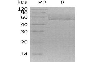 Chemokine (C-X3-C Motif) Ligand 1 (CX3CL1) protein (His tag)