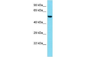 Host: Rabbit  Target Name: Coro2b  Sample Tissue: Mouse Lung lysates  Antibody Dilution: 1. (CORO2B antibody  (N-Term))