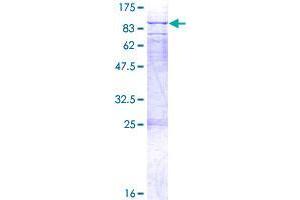 Image no. 1 for Williams-Beuren Syndrome Chromosome Region 17 (WBSCR17) (AA 1-598) protein (GST tag) (ABIN1325179) (WBSCR17 Protein (AA 1-598) (GST tag))