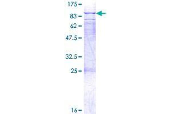 WBSCR17 Protein (AA 1-598) (GST tag)